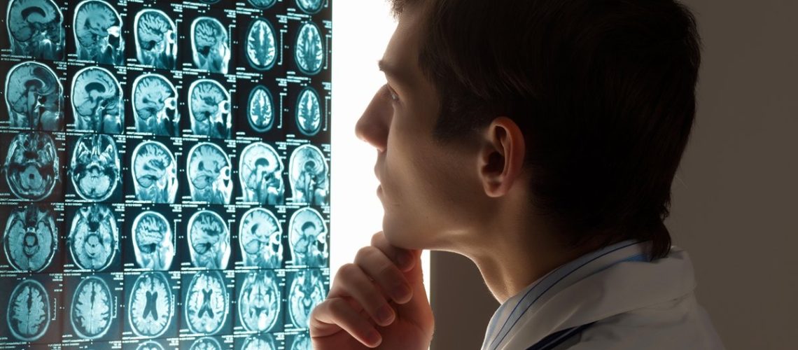 hemorragia cerebral